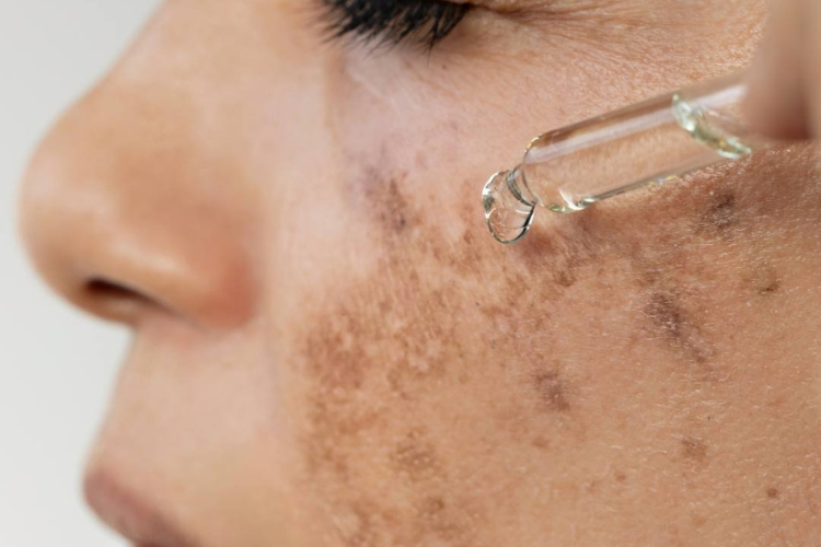 Uneven Skin Tone Isn’t Just About Dark Spots….It’s About Skin Signaling